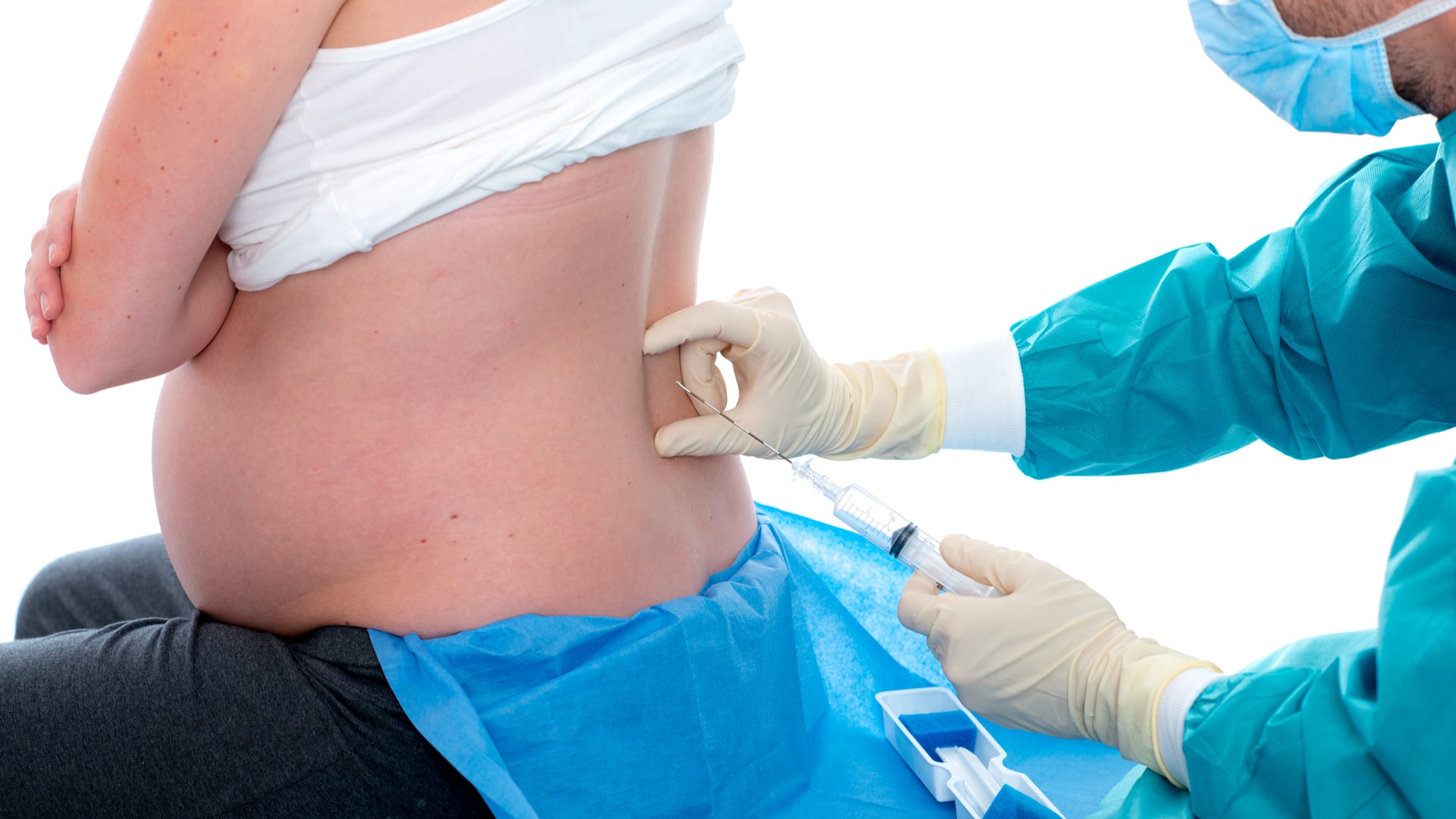 Un nuevo estudio descarta que la anestesia epidural cause autismo