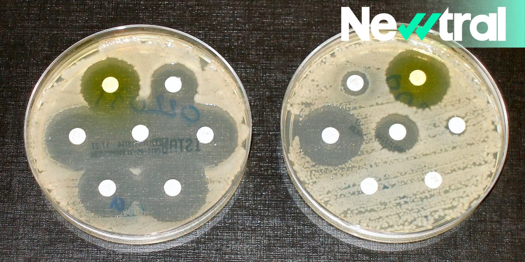 mape おまとめP. Bacteria (TC)【51】【41】【40】 Aumentan en EEUU las infecciones por bacterias – Telemundo McAllen